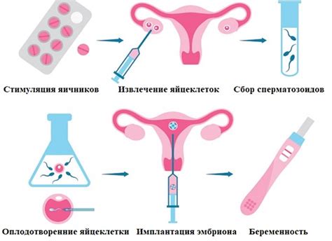 Влияние фолликула на процессы искусственного и экстракорпорального оплодотворения