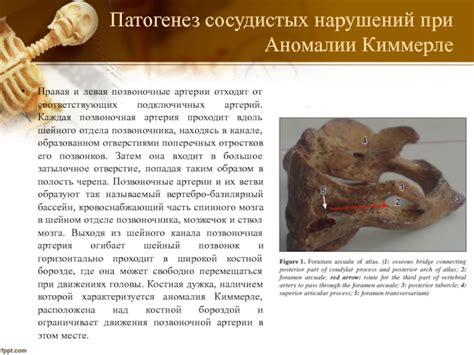 Возможность развития сосудистых нарушений и головных болей