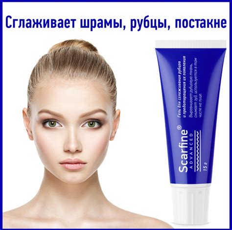 Добавление фосфора для предотвращения появления желтизны