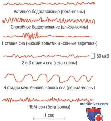Значимость регулярного отдыха и качественного сна для поддержания активности мозга