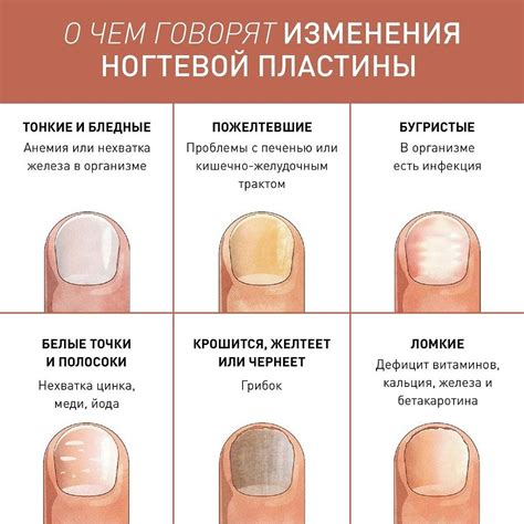 Ошибочные действия при удалении покрытия для ногтей