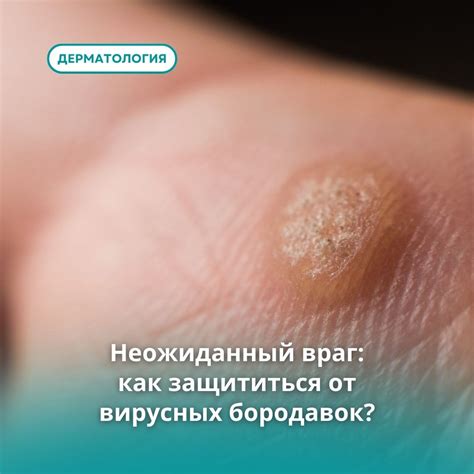 Помните, что профилактика лучше лечения