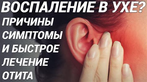 Причины пронизанного левого уха у юных господ: