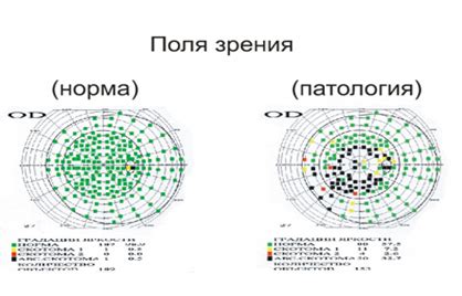 Рекомендации и основные принципы согласования поля зрения в игре Ассасин