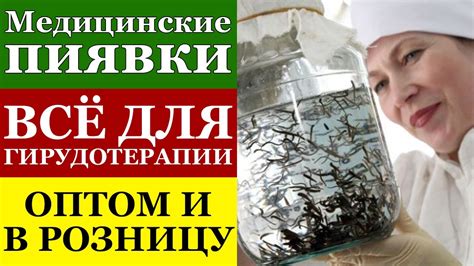 Рекомендации по уходу за пиявками после применения